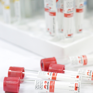 Вакуумные пробирки с активатором свертывания крови, 13х75 мм, 2 мл, пластик